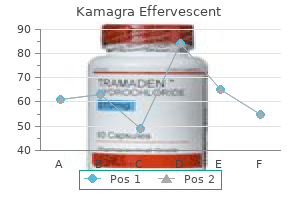 generic 100 mg kamagra effervescent otc