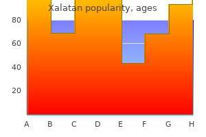 generic 2.5 ml xalatan