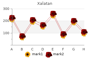 trusted xalatan 2.5 ml