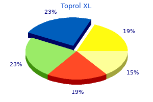 order toprol xl 50 mg fast delivery