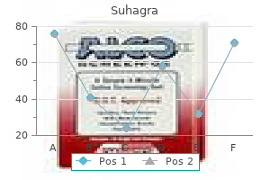 cheap 50 mg suhagra otc