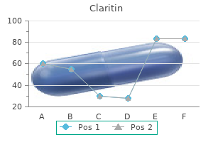 generic claritin 10mg online