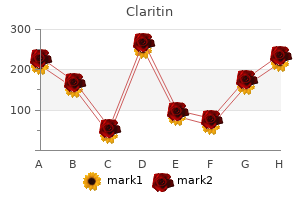 claritin 10mg for sale