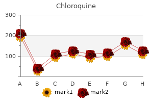 safe 250mg chloroquine
