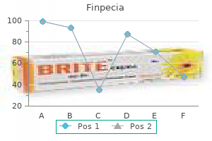 generic finpecia 1 mg line