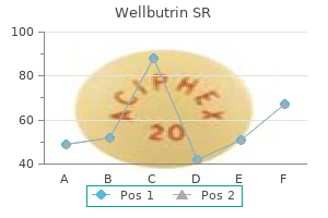wellbutrin sr 150 mg