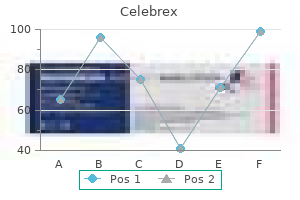 buy cheap celebrex 200 mg line