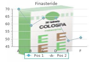 buy finasteride 1 mg line