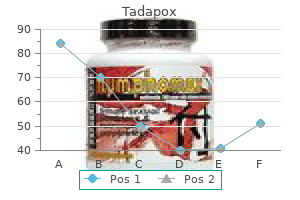 order 80mg tadapox free shipping